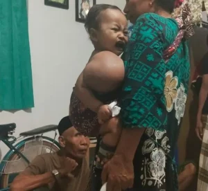 Lengannya Terus Membesar, Bayi 11 Bulan Ini Harus segera Dioperasi