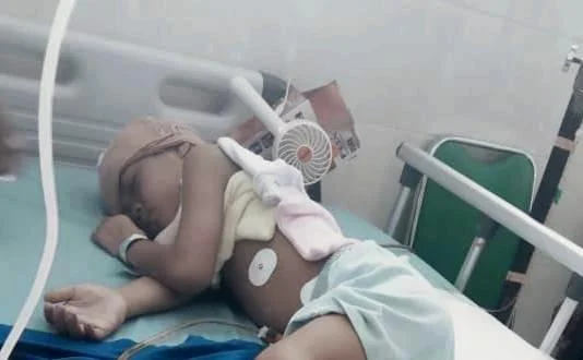 Lazismu Pacitan Tangani Dua Pasien Anak, Begini Kondisinya