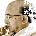 Pikun Jangan, Apalagi Alzheimer