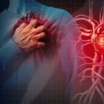 Mengantisipasi Henti Jantung Mendadak