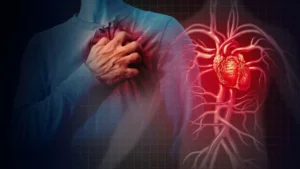 Mengantisipasi Henti Jantung Mendadak