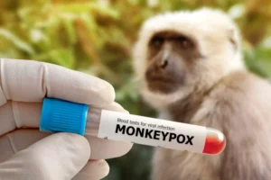 Darurat Kesehatan Dunia Cacar Monyet: Penyebab, Penularan, dan Cara Penanganannya