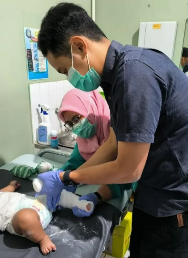 Program MENTARI Clubfoot Layani 161 Anak dengan Kaki Pengkor di Tiga Provinsi