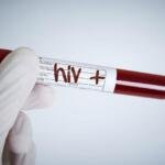 9 Calon Pengantin Terdeteksi HIV di Gresik, Ini Penjelasan Pakar Umsura tentang Skrining Pranikah