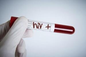 9 Calon Pengantin Terdeteksi HIV di Gresik, Ini Penjelasan Pakar Umsura tentang Skrining Pranikah